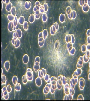 LiveBloodAnalysis1