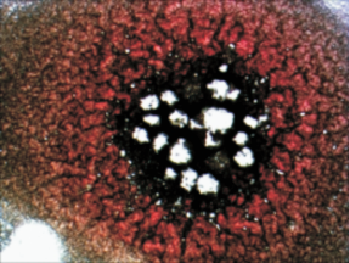 LiveBloodAnalysis3