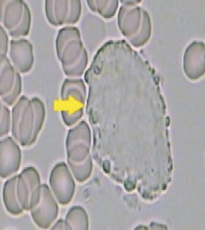 LiveBloodAnalysis4